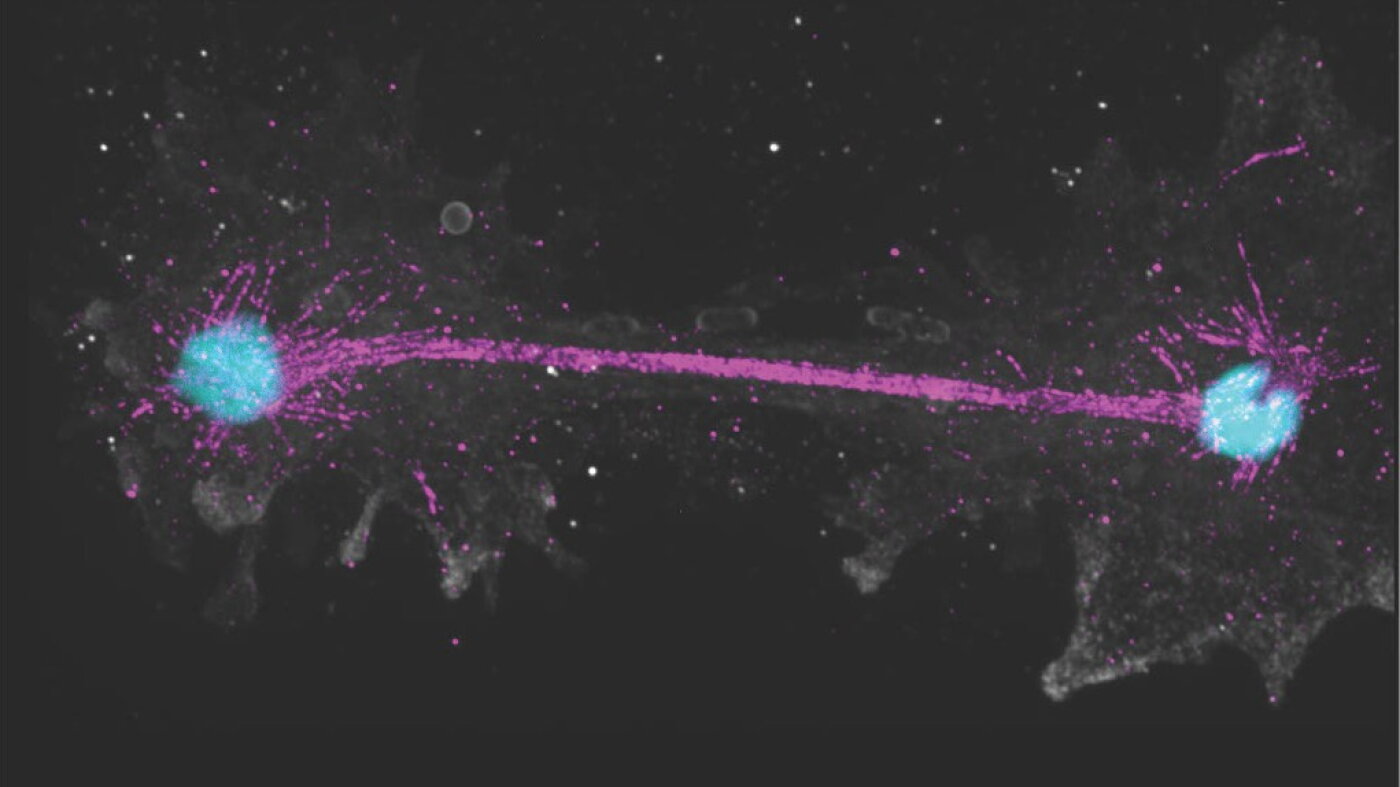 This 'fire amoeba' pushes the limit of what's possible for complex life – NPR