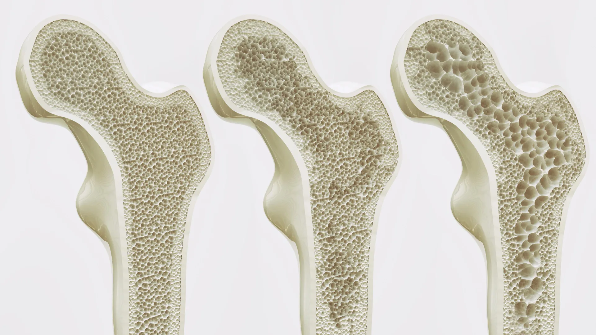 Too much coffee may weaken bones, study finds