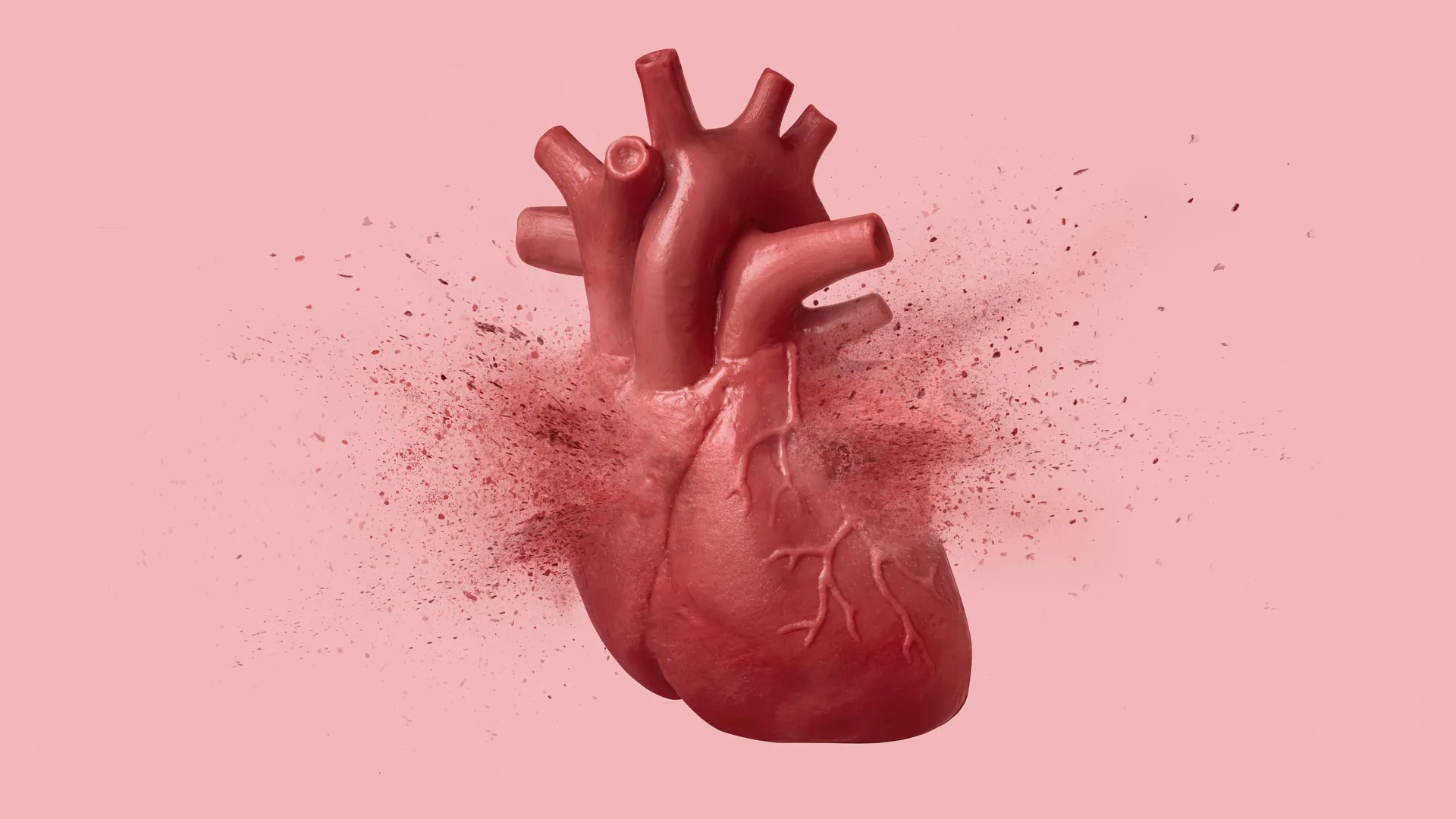 “Broken heart syndrome” can look just like a heart attack. This test can tell them apart