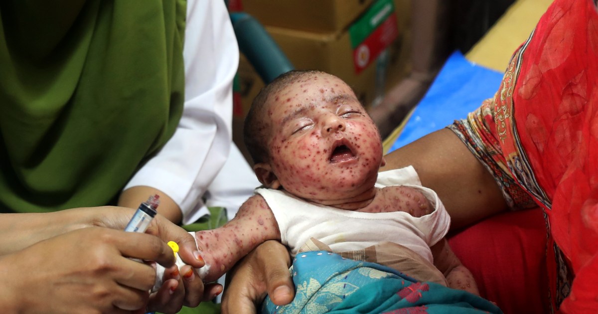 Measles outbreak in Bangladesh is a ‘real warning’ to other nations, experts say – NBC News